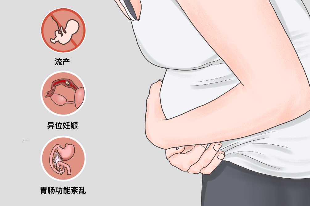 早期怀孕反应的五大因